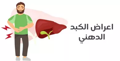 اعراض الكبد الدهني