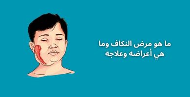 ما هو مرض النكاف وما هي أعراضه وعلاجه